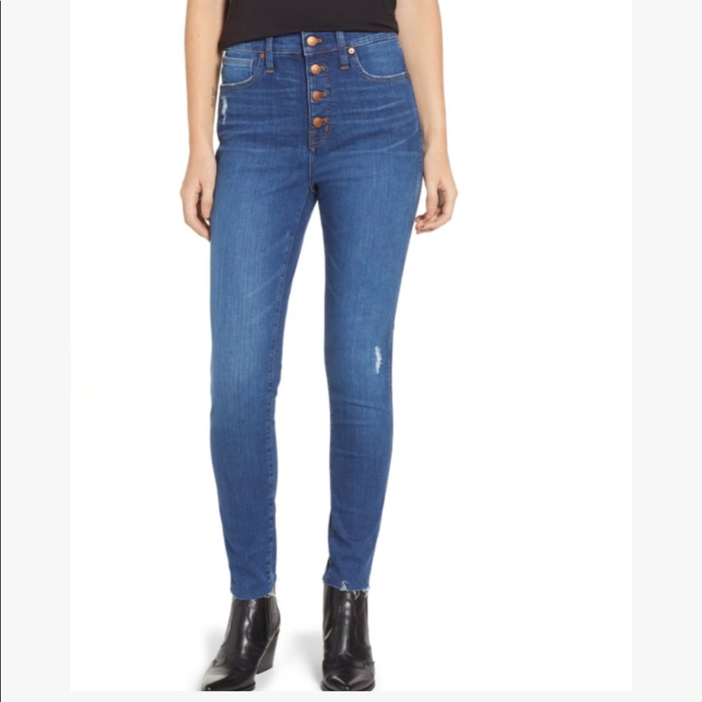 Madewell Button-Front 10” High Rise Skinny Jeans